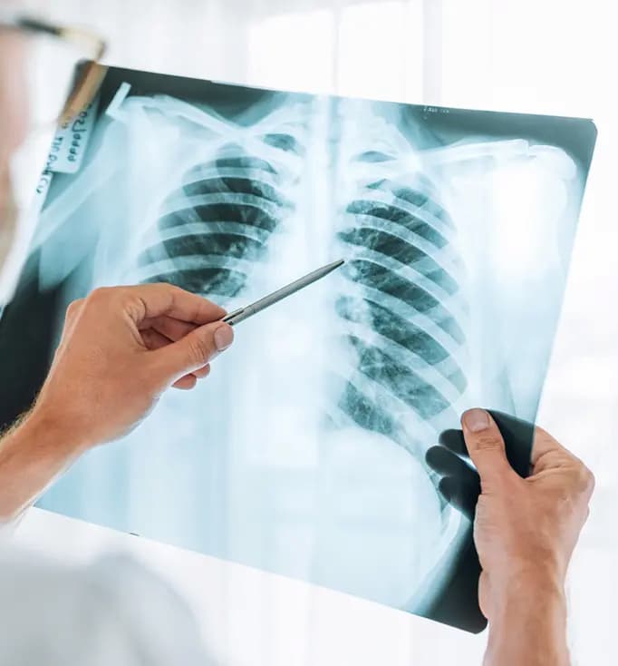 Philadelphia Lung Cancer Lawyer