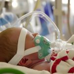Traumatic Birth Effects on Baby | Lasting Health Impacts