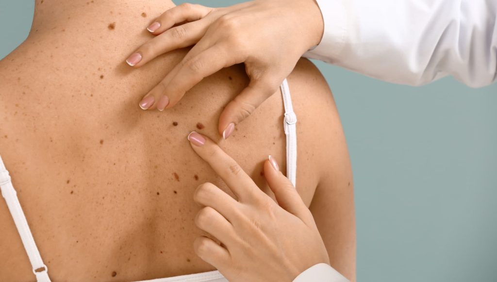 doctors misdiagnosed cancer