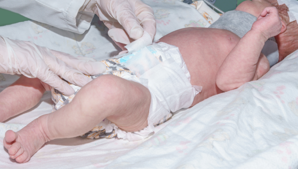 medical malpractice negligence claim
